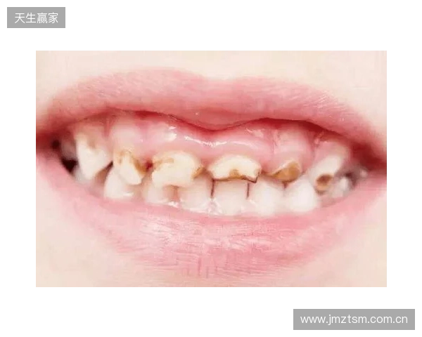 韦林顿确诊上唇部贯通伤；11、21牙半脱位；上颌前牙区牙槽骨骨折